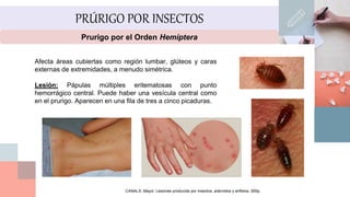 Prurigo por insectos
