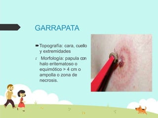 GARRAPATA
Topografía: cara, cuello
y extremidades
 Morfología: papula con
halo eritematoso o
equimótico > 4 cm o
ampolla o zona de
necrosis.
 