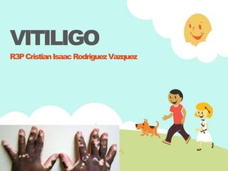 VITILIGO
R3PCristianIsaacRodriguezVazquez
 