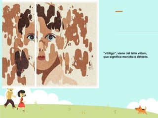 “vitíligo”, viene del latín vitium,
que significa mancha o defecto.
 