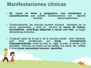 Manifestaciones clínicas
 Su curso es lento y progresivo, con remisiones y
exacerbaciones que pueden correlacionarse con algunos
factores desencadenantes.
 Ocasionalmente, las máculas pueden iniciarse alrededor de un
nevus pigmentado, y toma el nombre de nevus de Sutton,
leucodermia centrífuga adquirida o nevus con halo y, luego,
afectaráreas distantes.
 Cualquier parte de la piel o de la mucosa puede estar afectada,
pero tiene predilección por áreas normalmente
hiperpigmentadas, como la cara, la ingle, la axila, la areola y los
genitales. Además, es común en los tobillos, los codos, las rodillas
y otras áreas expuestasa traumas repetidos.
 