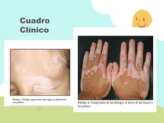 Cuadro
Clínico
 