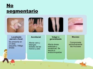 No
segmentario
Localizado
parcial o focal.
Se presenta en
un área
pequeña. Vitiligo
areata
Acrofacial
Afecta cara y
falanges
distales de las
manos y pies
Vulgar o
generalizado
Afecta áreas
extensas y
simétricas. Se
asocia a
endocrinopatías
Mucoso
Compromete
exclusivamente
las mucosas
 