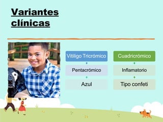 Variantes
clínicas
Vitiligo Tricrómico
Pentacrómico
Azul
Cuadricrómico
Inflamatorio
Tipo confeti
 