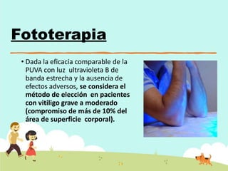 Fototerapia
• Dada la eficacia comparable de la
PUVA con luz ultravioleta B de
banda estrecha y la ausencia de
efectos adversos, se considera el
método de elección en pacientes
con vitiligo grave a moderado
(compromiso de más de 10% del
área de superficie corporal).
 