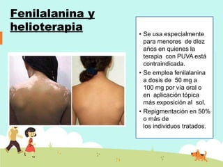 Fenilalanina y
helioterapia
• Se usa especialmente
para menores de diez
años en quienes la
terapia con PUVA está
contraindicada.
• Se emplea fenilalanina
a dosis de 50 mg a
100 mg por vía oral o
en aplicación tópica
más exposición al sol.
• Repigmentación en 50%
o más de
los individuos tratados.
 