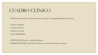 CUADRO CLÍNICO
◦ Dermatosis diseminada a diferentes partes del cuerpo (la topografía depende de la causa)
◦ Lesiones papulosas
◦ Costras hemáticas
◦ Huellas de rascado
◦ Zonas liquenificadas
◦ IMPETIGO pustulas y costras melicéricas.
◦ DERMATITIS POR CONTACTO prurito, costras melicéricas y vesículas.