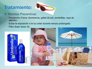 Tratamiento:
 Medidas Preventivas:
Prevención Física: Sombreros, gafas de sol, sombrillas, ropa de
algodón.
Evitar la exposición a la luz solar durante tiempo prolongado.
Filtro Solar factor 50.
 