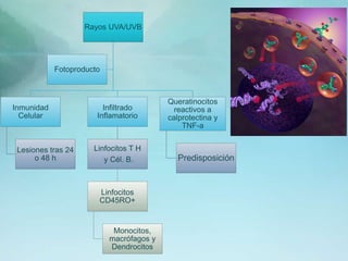 Rayos UVA/UVB
Inmunidad
Celular
Lesiones tras 24
o 48 h
Infiltrado
Inflamatorio
Linfocitos T H
y Cél. B.
Linfocitos
CD45RO+
Monocitos,
macrófagos y
Dendrocitos
Queratinocitos
reactivos a
calprotectina y
TNF-a
Predisposición
Fotoproducto
 