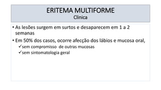 ERITEMA MULTIFORME
Clinica
• As lesões surgem em surtos e desaparecem em 1 a 2
semanas
• Em 50% dos casos, ocorre afecção dos lábios e mucosa oral,
✓sem compromisso de outras mucosas
✓sem sintomatologia geral
 