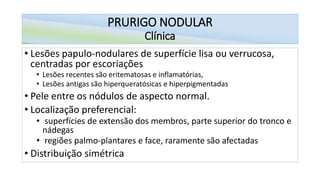 PRURIGO NODULAR
Clínica
• Lesões papulo-nodulares de superfície lisa ou verrucosa,
centradas por escoriações
• Lesões recentes são eritematosas e inflamatórias,
• Lesões antigas são hiperqueratósicas e hiperpigmentadas
• Pele entre os nódulos de aspecto normal.
• Localização preferencial:
• superfícies de extensão dos membros, parte superior do tronco e
nádegas
• regiões palmo-plantares e face, raramente são afectadas
• Distribuição simétrica
 