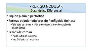 PRURIGO NODULAR
Diagnóstico Diferencial
• Liquen plano hipertrófico
• Formas papulonodulares do Penfigoide Bolhoso
✓Biópsia cutânea + IFD, permitem a confirmação do
diagnóstico
• Lesões de coceira
✓na Insuficiência renal
✓ na Colestase hepática
 
