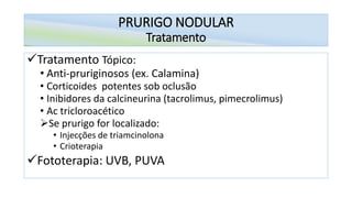 PRURIGO NODULAR
Tratamento
✓Tratamento Tópico:
• Anti-pruriginosos (ex. Calamina)
• Corticoides potentes sob oclusão
• Inibidores da calcineurina (tacrolimus, pimecrolimus)
• Ac tricloroacético
➢Se prurigo for localizado:
• Injecções de triamcinolona
• Crioterapia
✓Fototerapia: UVB, PUVA
 