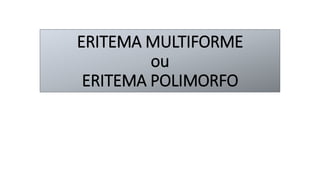 ERITEMA MULTIFORME
ou
ERITEMA POLIMORFO
 