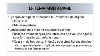 ERITEMA MULTIFORME
• Reacção de hipersensibilidade mucocutânea de origem
✓Infecciosa
✓Medicamentosa
• Considerado pela maioria dos autores como:
✓Reacção imunoalérgica pós-infecciosa de evolução aguda,
com formas clinicas major e minor,
✓Causa mais frequente: infecção pelo virus herpes simples
Outro agente infeccioso implicado é o Mycoplasma pneumoniae,
observada nas formas major
 