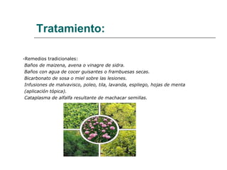 Tratamiento: -Remedios tradicionales:  Baños de maizena, avena o vinagre de sidra. Baños con agua de cocer guisantes o frambuesas secas. Bicarbonato de sosa o miel sobre las lesiones. Infusiones de malvavisco, poleo, tila, lavanda, espliego, hojas de menta  (aplicación tópica). Cataplasma de alfalfa resultante de machacar semillas. 
