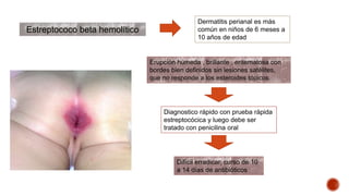 Estreptococo beta hemolítico 
Dermatitis perianal es más 
común en niños de 6 meses a 
10 años de edad 
Erupción húmeda , brillante , eritematosa con 
bordes bien definidos sin lesiones satélites, 
que no responde a los esteroides tópicos. 
Diagnostico rápido con prueba rápida 
estreptocócica y luego debe ser 
tratado con penicilina oral 
Difícil erradicar, curso de 10 
a 14 días de antibióticos 
 