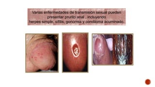 Varias enfermedades de transmisión sexual pueden 
presentar prurito anal , incluyendo 
herpes simple, sífilis, gonorrea y condiloma acuminado. 
 
