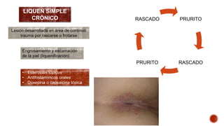 LIQUEN SIMPLE 
CRÓNICO 
Lesión desarrollada en área de continuo 
trauma por rascarse o frotarse 
Engrosamiento y escamación 
de la piel (liquenificación) 
PRURITO 
RASCADO 
PRURITO RASCADO 
• Esteroides tópicos 
• Antihistamínicos orales 
• Doxepina o capsaicina tópica 
 