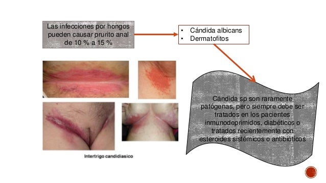 El ungüento de cera de la psoriasis
