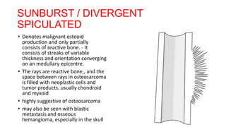periosteal reaction radiology review.pptx