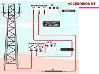 ACCESORIOS MT
 