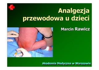 Analgezja
przewodowa u dzieci
                Marcin Rawicz




     Akademia Medyczna w Warszawie
     Akademia Medyczna w Warszawie
 