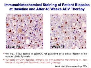  0.8 log10 (84%) decline in cccDNA, not paralleled by a similar decline in the
number of HBcAg+ cells
 Suggests cccDNA depleted primarily by non-cytopathic mechanisms or new
rounds of hepatocyte infection occurred during therapy
Baseline Week 48
Werle et al, Gastroenterology 2004
 