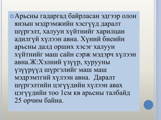 Арьсны гадаргад байрласан эдгээр олон
янзын мэдрэмжийн хэсгүүд даралт
шүргэлт, халуун хүйтнийг харилцан
адилгүй хүлээн авна. Хүний биеийн
арьсны далд орших хэсэг халуун
хүйтнийг маш сайн сэрж мэдэрч хүлээн
авна.Ж:Хэлний үзүүр, хурууны
үзүүрүүд шүргэлийг маш маш
мэдрэмтгий хүлээн авна. Даралт
шүргэлтийн цэгүүдийн хүлээн авах
цэгүүдийн тоо 1см кв арьсны талбайд
25 орчим байна.
 
