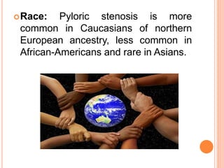 Race: Pyloric stenosis is more
common in Caucasians of northern
European ancestry, less common in
African-Americans and rare in Asians.
 