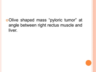 Olive shaped mass “pyloric tumor” at
angle between right rectus muscle and
liver.
 