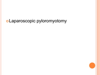 Laparoscopic pyloromyotomy
 