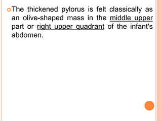 The thickened pylorus is felt classically as
an olive-shaped mass in the middle upper
part or right upper quadrant of the infant's
abdomen.
 