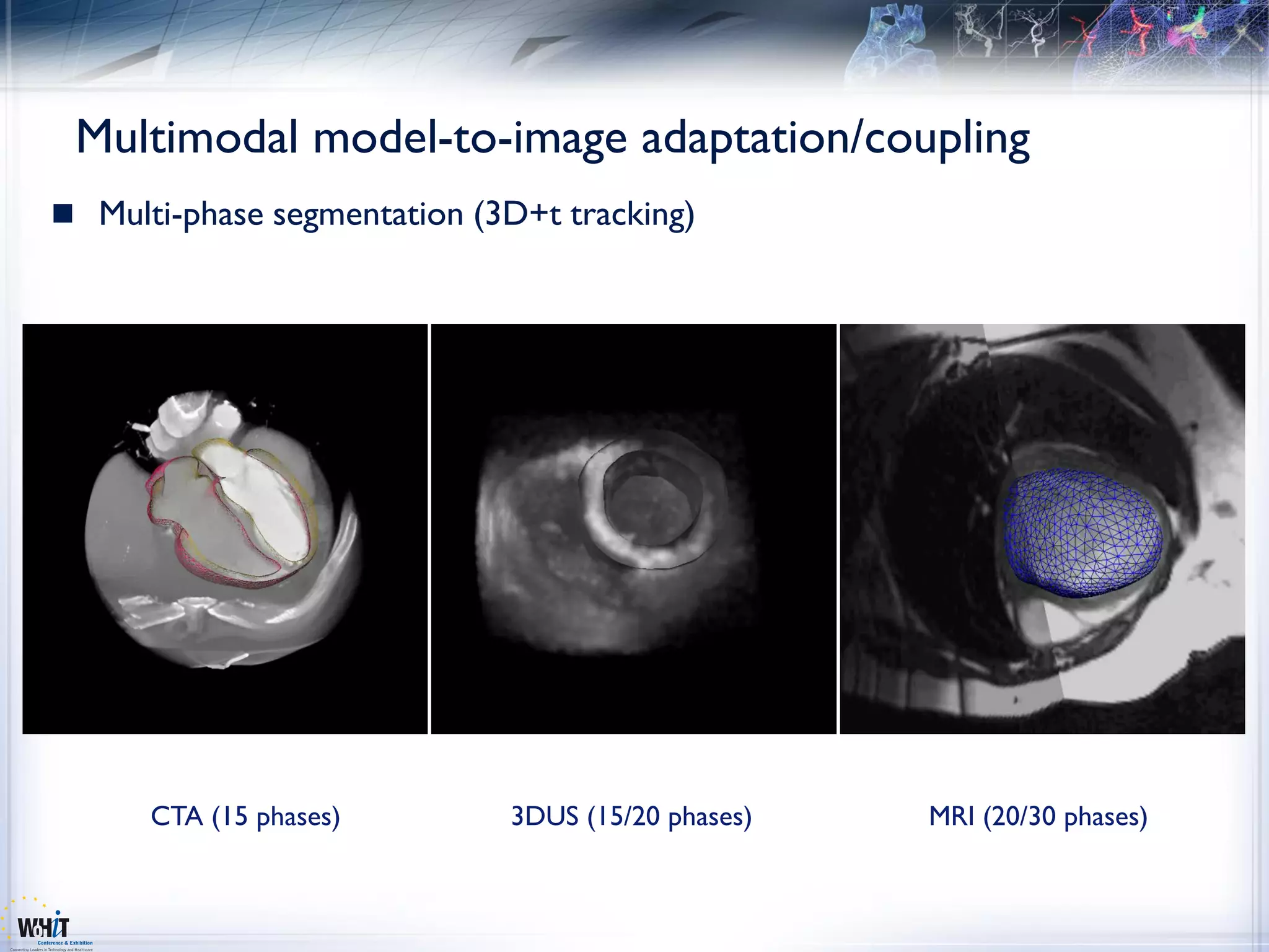 Multimodal model-to-image adaptation/coupling
 Multi-phase segmentation (3D+t tracking)




      CTA (15 phases)        3DUS (15/20 phases)   MRI (20/30 phases)
 