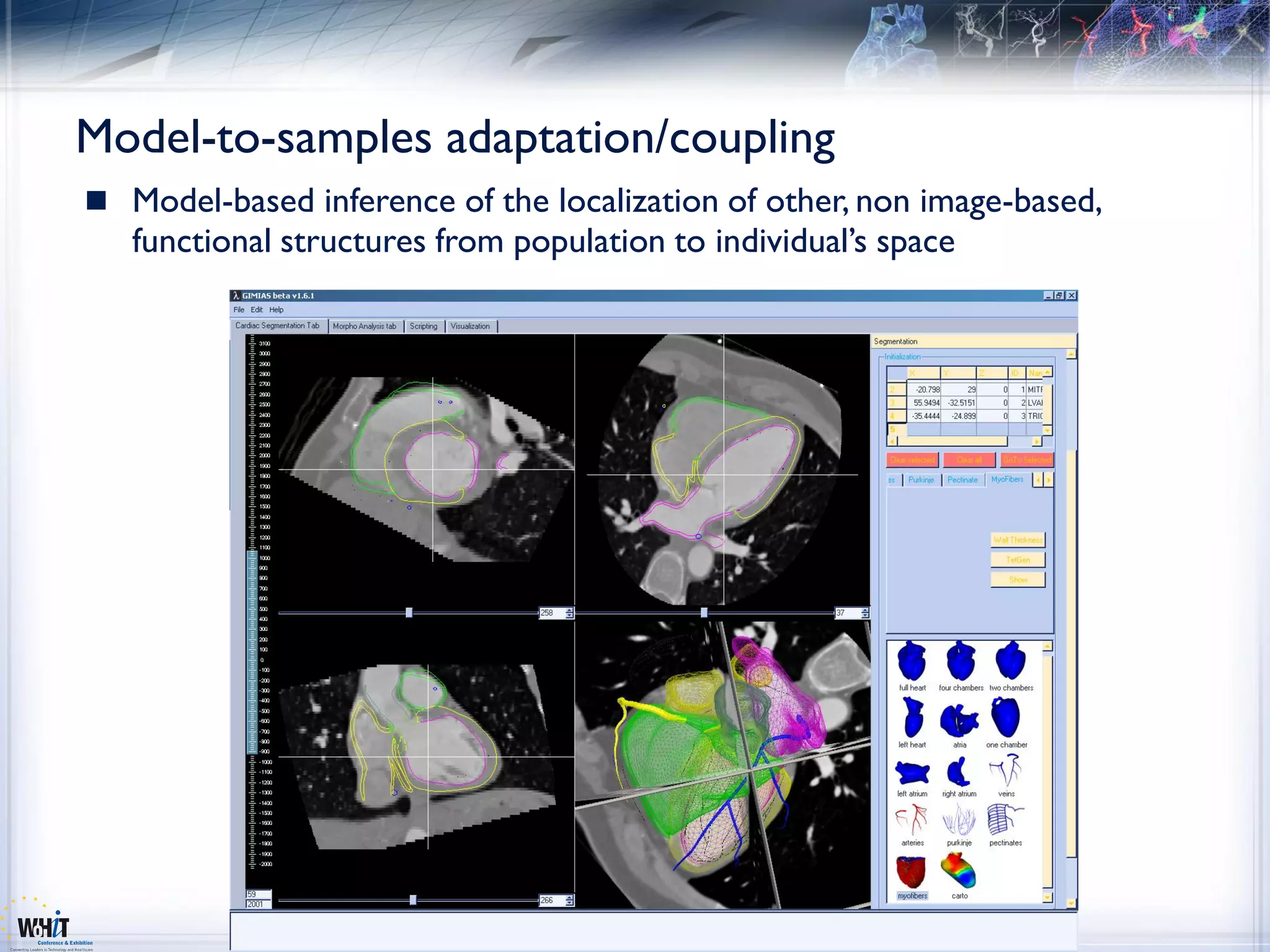 Model-to-samples adaptation/coupling
 Model-based inference of the localization of other, non image-based,
   functional structures from population to individual’s space
 