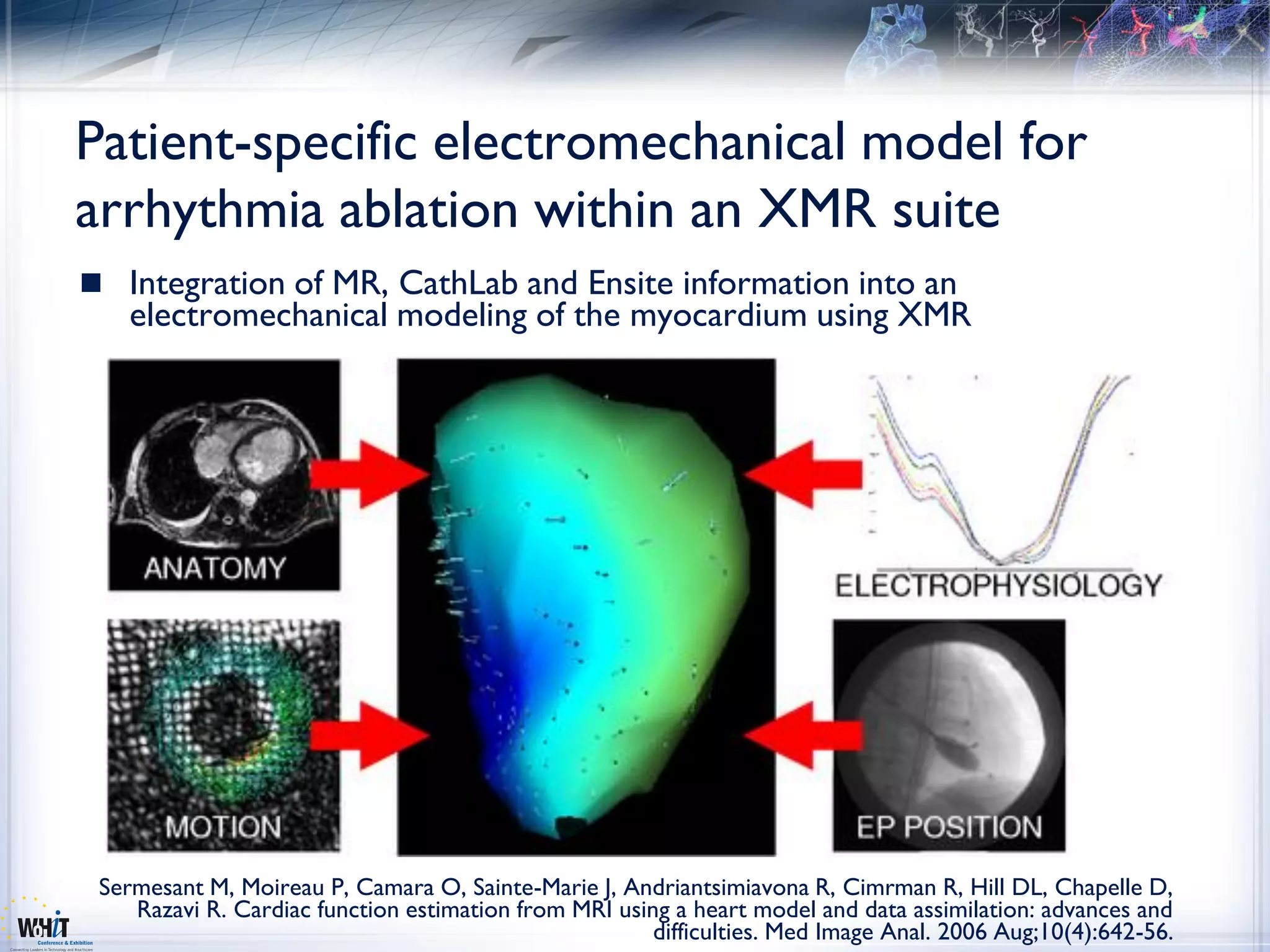 Patient-specific electromechanical model for
arrhythmia ablation within an XMR suite
 Integration of MR, CathLab and Ensite information into an
    electromechanical modeling of the myocardium using XMR




 Sermesant M, Moireau P, Camara O, Sainte-Marie J, Andriantsimiavona R, Cimrman R, Hill DL, Chapelle D,
    Razavi R. Cardiac function estimation from MRI using a heart model and data assimilation: advances and
                                                       difficulties. Med Image Anal. 2006 Aug;10(4):642-56.
 
