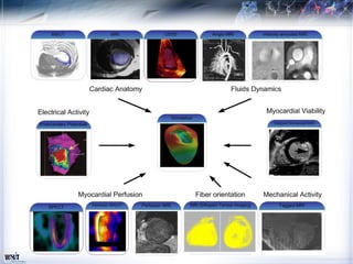 Vph2 Model ICT for a global infrastructure for health research VPH Models, images ...