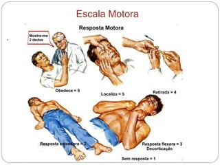 . Escala Motora 