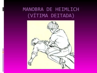 MANOBRA DE HEIMLICH (VÍTIMA DEITADA) 