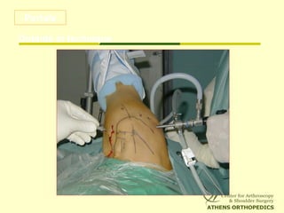 Portals
Outside in technique
 