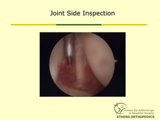 Joint Side Inspection
 