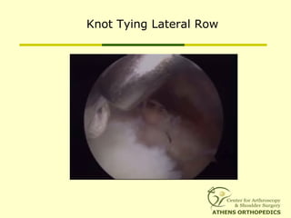 Knot Tying Lateral Row
 