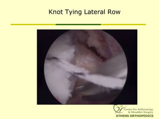 Knot Tying Lateral Row
 