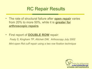 RC Repair Results
• The rate of structural failure after open repair varies
from 20% to more 50%, while it is greater for
arthroscopic repairs
• First report of DOUBLE ROW repair:
Fealy S, Kingham TP, Altchek DW, Arthoscopy July 2002
Mini-open Rot cuff repair using a two row fixation technique
www.shoulder.gr
 