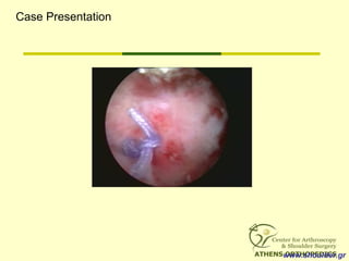 www.shoulder.gr
Case Presentation
 