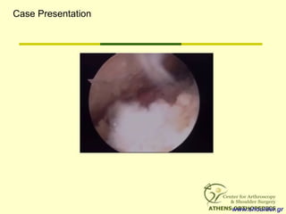 www.shoulder.gr
Case Presentation
 