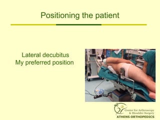 Positioning the patient
Lateral decubitus
My preferred position
 