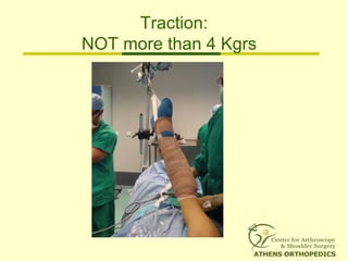 Traction:
NOT more than 4 Kgrs
 
