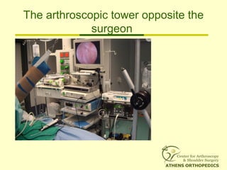 The arthroscopic tower opposite the
surgeon
 