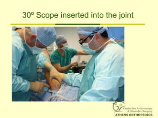 30º Scope inserted into the joint
 